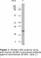 Eukaryotic Translation Initiation Factor 4E Binding Protein 1 antibody, LS-C47199, Lifespan Biosciences, Western Blot image 