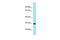 Orofacial Cleft 1 Candidate 1 antibody, PA5-45914, Invitrogen Antibodies, Western Blot image 