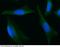 N(Alpha)-Acetyltransferase 10, NatA Catalytic Subunit antibody, 14293-MM08, Sino Biological, Immunohistochemistry frozen image 