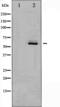 AKT Serine/Threonine Kinase 2 antibody, abx010370, Abbexa, Western Blot image 