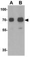 CREB Regulated Transcription Coactivator 2 antibody, GTX31879, GeneTex, Western Blot image 