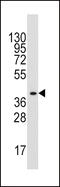 Aldolase, Fructose-Bisphosphate A antibody, 61-457, ProSci, Western Blot image 