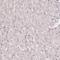 Centromere Protein F antibody, HPA064308, Atlas Antibodies, Immunohistochemistry paraffin image 