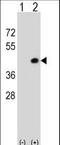 Death Associated Protein Kinase 2 antibody, LS-C164360, Lifespan Biosciences, Western Blot image 