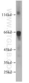 Tetratricopeptide Repeat Domain 39A antibody, 21323-1-AP, Proteintech Group, Western Blot image 