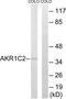 Aldo-Keto Reductase Family 1 Member C2 antibody, TA313748, Origene, Western Blot image 