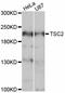 TSC Complex Subunit 2 antibody, abx127069, Abbexa, Western Blot image 