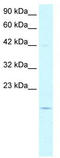 Prefoldin Subunit 1 antibody, TA332123, Origene, Western Blot image 