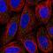 Mediator Complex Subunit 17 antibody, NBP2-57476, Novus Biologicals, Immunofluorescence image 