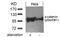 Catenin alpha-1 antibody, AP09467PU-S, Origene, Western Blot image 