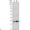 RAB10, Member RAS Oncogene Family antibody, LS-C812754, Lifespan Biosciences, Western Blot image 