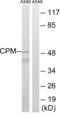 Carboxypeptidase M antibody, LS-C119820, Lifespan Biosciences, Western Blot image 