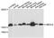 Ubiquitin Conjugating Enzyme E2 L6 antibody, A07315, Boster Biological Technology, Western Blot image 