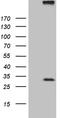 Regulator Of G Protein Signaling 17 antibody, LS-C792723, Lifespan Biosciences, Western Blot image 