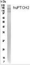 Patched 2 antibody, PA1-46223, Invitrogen Antibodies, Western Blot image 