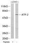 Activating Transcription Factor 2 antibody, 79-279, ProSci, Western Blot image 