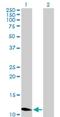 Zinc Finger Protein 695 antibody, H00057116-B01P, Novus Biologicals, Western Blot image 