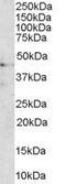 Melanocortin 3 Receptor antibody, GTX89585, GeneTex, Western Blot image 