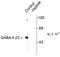 Gamma-Aminobutyric Acid Type A Receptor Beta3 Subunit antibody, PA5-35390, Invitrogen Antibodies, Western Blot image 