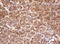 Proteasome Subunit Alpha 2 antibody, M08901, Boster Biological Technology, Immunohistochemistry paraffin image 