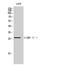 CCAAT Enhancer Binding Protein Delta antibody, A03499, Boster Biological Technology, Western Blot image 
