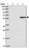 Zinc Finger Protein 212 antibody, PA5-62051, Invitrogen Antibodies, Western Blot image 