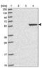 Zinc Finger Protein 212 antibody, PA5-62051, Invitrogen Antibodies, Western Blot image 