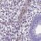 Chloride Intracellular Channel 4 antibody, NBP2-49321, Novus Biologicals, Immunohistochemistry paraffin image 