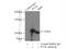 Glycogen phosphorylase, liver form antibody, 15851-1-AP, Proteintech Group, Immunoprecipitation image 