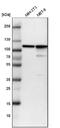 Actinin Alpha 4 antibody, NBP1-89818, Novus Biologicals, Western Blot image 