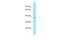 Ankyrin Repeat Family A Member 2 antibody, A12939, Boster Biological Technology, Western Blot image 