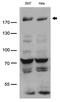 Bromodomain Adjacent To Zinc Finger Domain 1B antibody, LS-C793136, Lifespan Biosciences, Western Blot image 