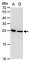 Triosephosphate Isomerase 1 antibody, GTX630778, GeneTex, Western Blot image 