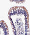 Aldehyde Dehydrogenase 6 Family Member A1 antibody, LS-C156268, Lifespan Biosciences, Immunohistochemistry paraffin image 