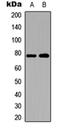 SKI Like Proto-Oncogene antibody, orb315703, Biorbyt, Western Blot image 