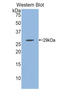 Interferon Alpha And Beta Receptor Subunit 1 antibody, LS-C294741, Lifespan Biosciences, Western Blot image 