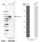 Collagen Type XIII Alpha 1 Chain antibody, PA5-62179, Invitrogen Antibodies, Western Blot image 