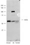 Synaptotagmin 3 antibody, NBP1-59689, Novus Biologicals, Western Blot image 