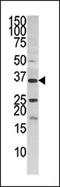 Pantothenate Kinase 3 antibody, AP13807PU-N, Origene, Western Blot image 