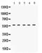 LCK Proto-Oncogene, Src Family Tyrosine Kinase antibody, PA5-79587, Invitrogen Antibodies, Western Blot image 