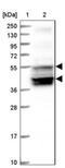 Solute Carrier Family 38 Member 7 antibody, NBP1-87910, Novus Biologicals, Western Blot image 