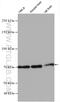 TBC1 Domain Family Member 15 antibody, 17252-1-AP, Proteintech Group, Western Blot image 