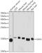 Serum amyloid A-3 protein antibody, GTX03433, GeneTex, Western Blot image 
