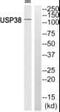 Ubiquitin Specific Peptidase 38 antibody, PA5-39512, Invitrogen Antibodies, Western Blot image 