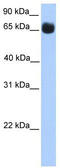 Zinc Finger Protein 433 antibody, TA339670, Origene, Western Blot image 