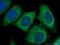 Protein Activator Of Interferon Induced Protein Kinase EIF2AK2 antibody, 10771-1-AP, Proteintech Group, Immunofluorescence image 