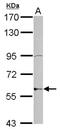 Zinc Finger Protein 596 antibody, NBP2-21032, Novus Biologicals, Western Blot image 