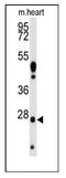 WDYHV Motif Containing 1 antibody, AP12459PU-N, Origene, Western Blot image 