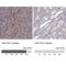 Unc-13 Homolog D antibody, NBP2-57827, Novus Biologicals, Immunohistochemistry paraffin image 