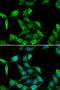 Guanidinoacetate N-Methyltransferase antibody, STJ28680, St John